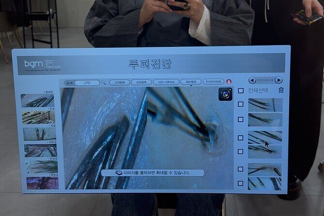 15 Step Stem Cell Scalp Treatment in Seoul - Final Thoughts