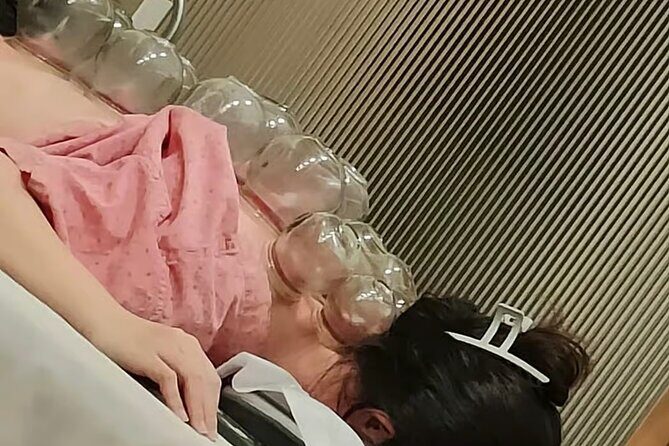 Acupuncture and Suction Cups Session at the Hospital - What to Expect from Your Session