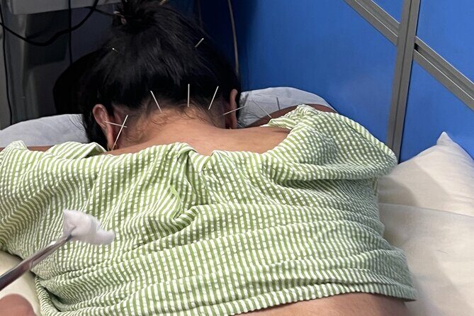 Acupuncture and Suction Cups Session at the Hospital - The Sum Up