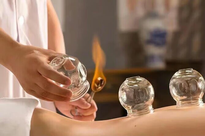 Acupuncture and Suction Cups Session at the Hospital - What We Like About the Acupuncture and Cupping Experience  