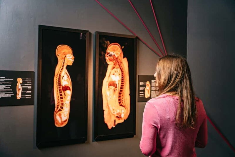 Berlin: Tickets for the BODY WORLDS Museum in Berlin - The Sum Up