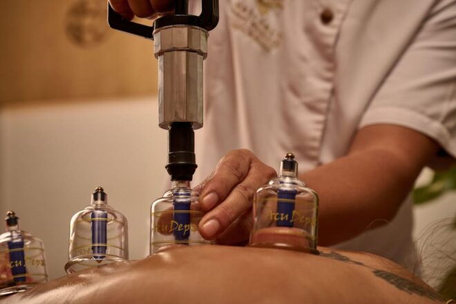 Cupping Therapy - Experience Overview
