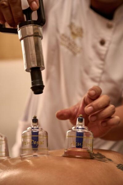 Cupping Therapy - Common Myths About Cupping