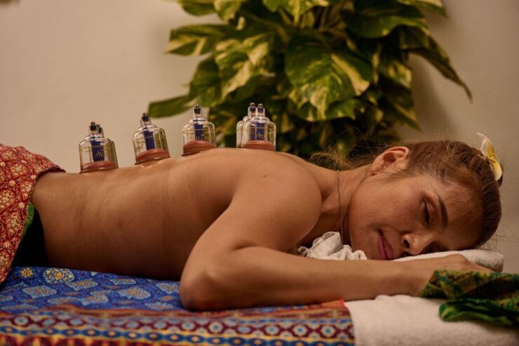 Cupping Therapy - Cupping Therapy Overview