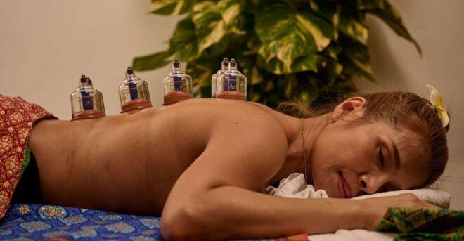 Cupping Therapy - Booking Information
