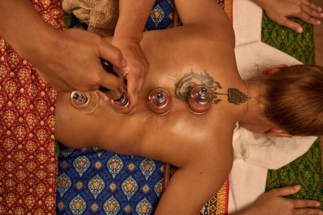 Cupping Therapy - Effective Treatments and Specialization