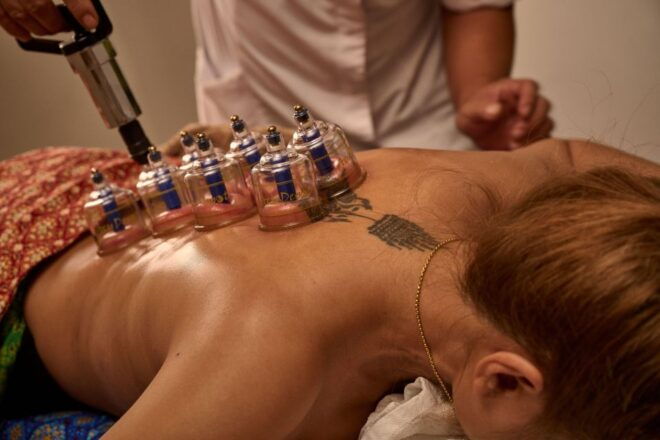 Cupping Therapy - Pricing and Duration