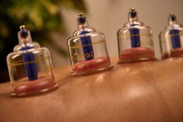 Cupping Therapy - Accessibility and Pickup Service
