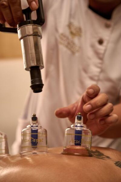 Cupping Therapy - Frequently Asked Questions