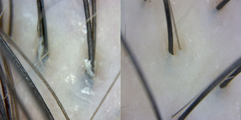 EcoJardin: Stem Cell Head Spa Experience in Jamsil LotteTower,Seoul - Choose between the 15-step and 18-step treatments