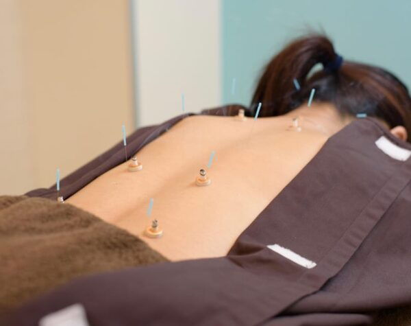 Hiroshima: Acupuncture and Japanese Unique Massage Treatment - Frequently Asked Questions