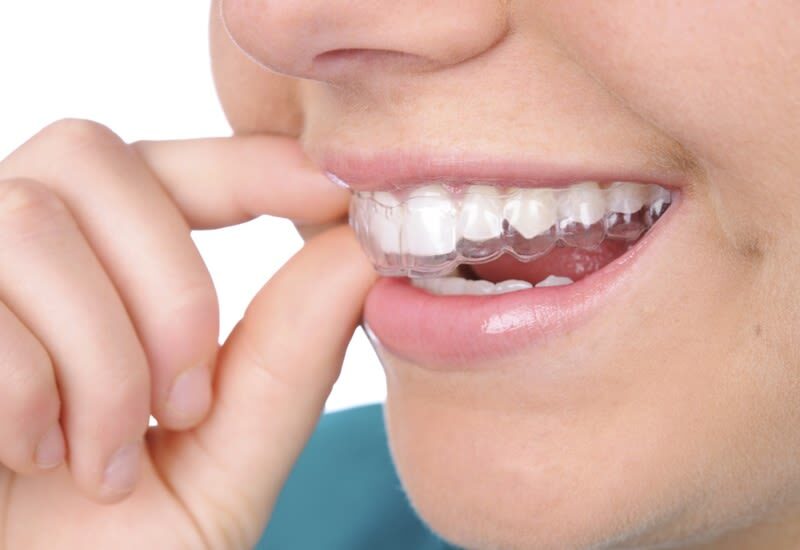 Ho Chi Minh Dental Clinic: Check Up, Whitening & Cleaning at Parkway - A dental appointment, not a sightseeing stop