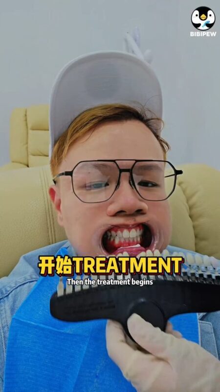 iSmile Professional Teeth Whitening Experience in Batam - Who will get the most from iSmile