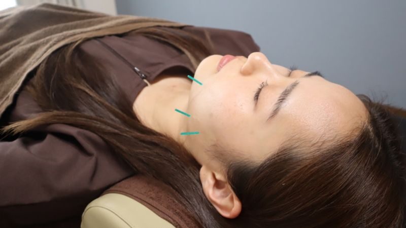 Japan Tokyo Acupuncture Clinic Reconditioning Jiyugaoka - Key points to know before you book