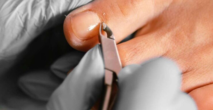 Pedicure Treatments and Foot and Nail Care. - Good To Know