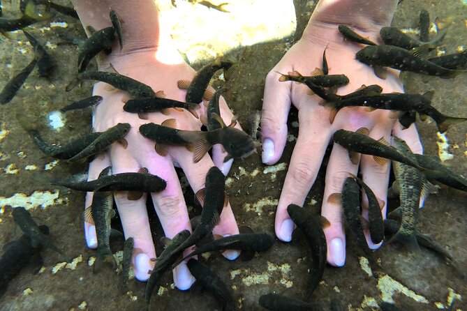 Psoriasis Fish Treatment by Garra Rufa Dr Fish in Turkey for 14 Days - Additional Information