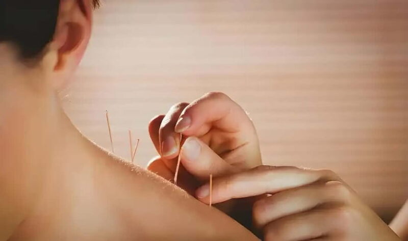 Shenzhen: Acupuncture Experience with TCM Practitioner - Is It Worth the Price?  