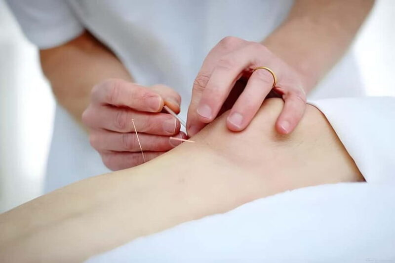 Shenzhen: Acupuncture Experience with TCM Practitioner - Frequently Asked Questions  