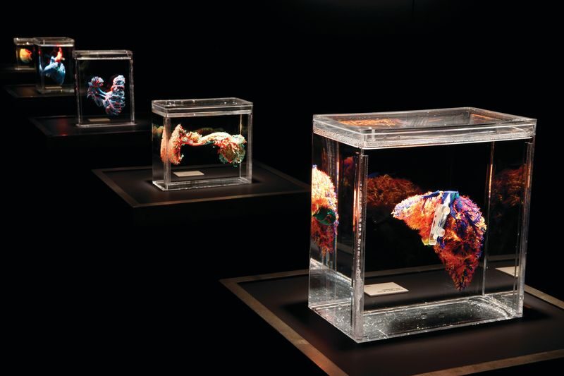 The Bodies Exhibition Ticket in Las Vegas - How to decide if the subject is right for you