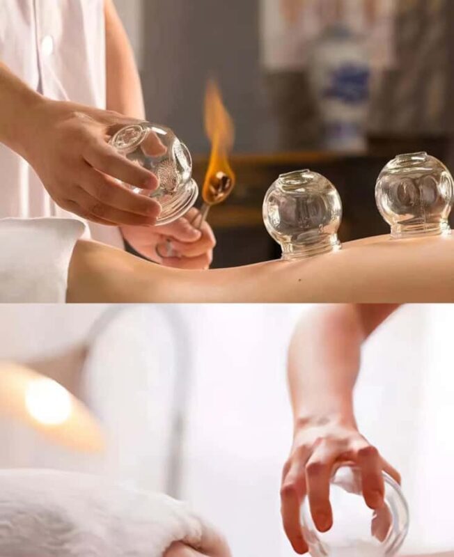 Traditional Chinese Medicine AcupunctureCupping Experience - Authentic Traditional Chinese Medicine: Acupuncture and Cupping Experience in Shanghai  