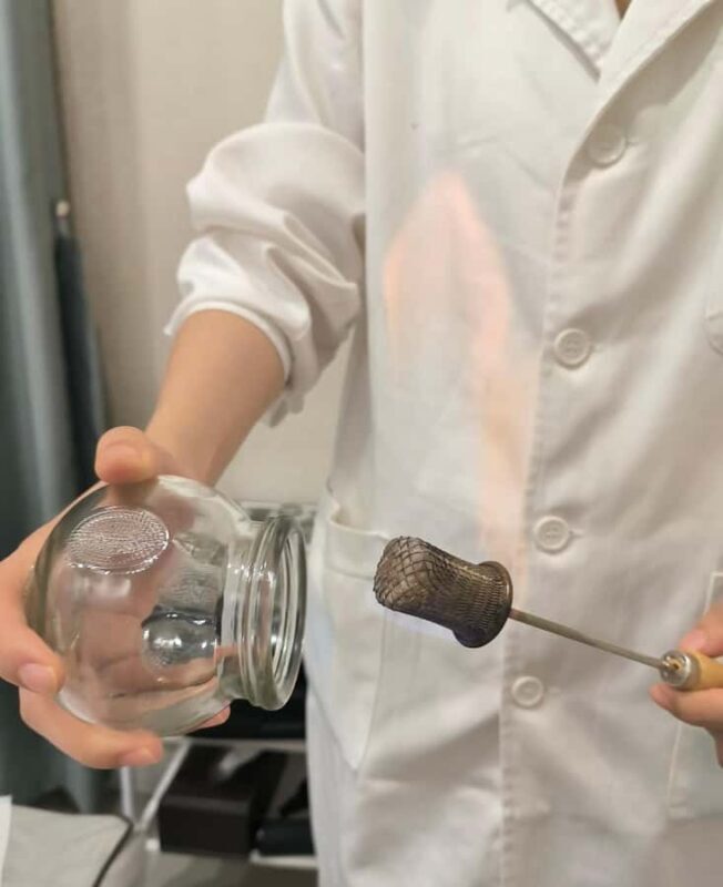 Traditional Chinese Medicine AcupunctureCupping Experience - Good To Know  