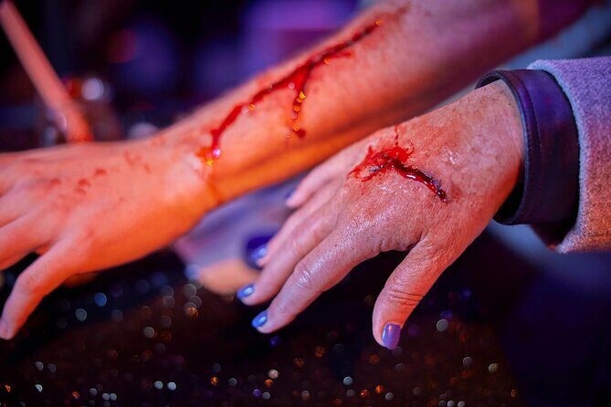 Wt Workshop Unleashed - Intro to Scars and Scrapes Workshop - Wt Workshop Unleashed - Intro to Scars and Scrapes Workshop: A Deep Dive